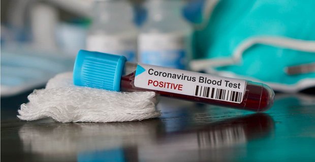 5 consejos de citas para la pandemia de coronavirus